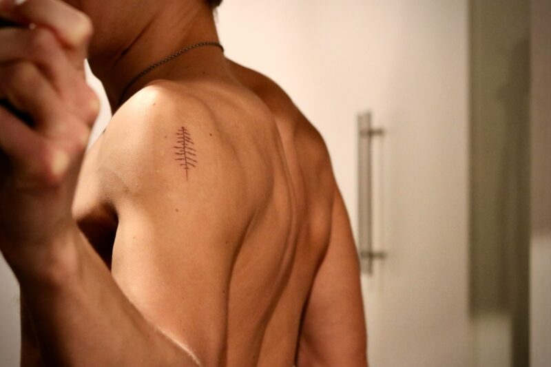 肩にパンチされたことによって肩に青紫色のあざができた男性の背面のイメージ画像